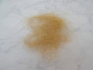 Een half jaar na de gastric sleeve operatie